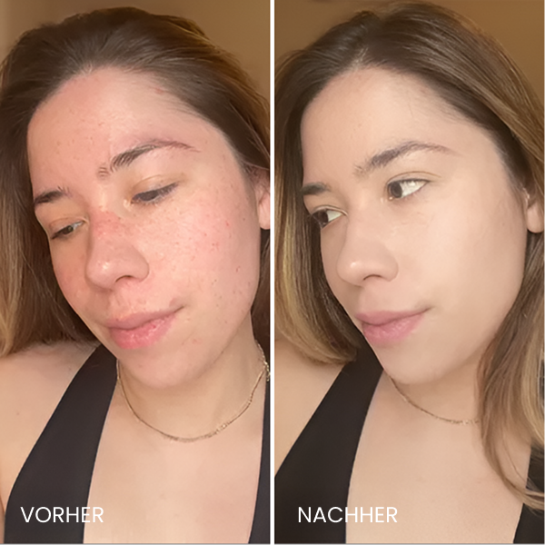Avant / Après de Elodie H.